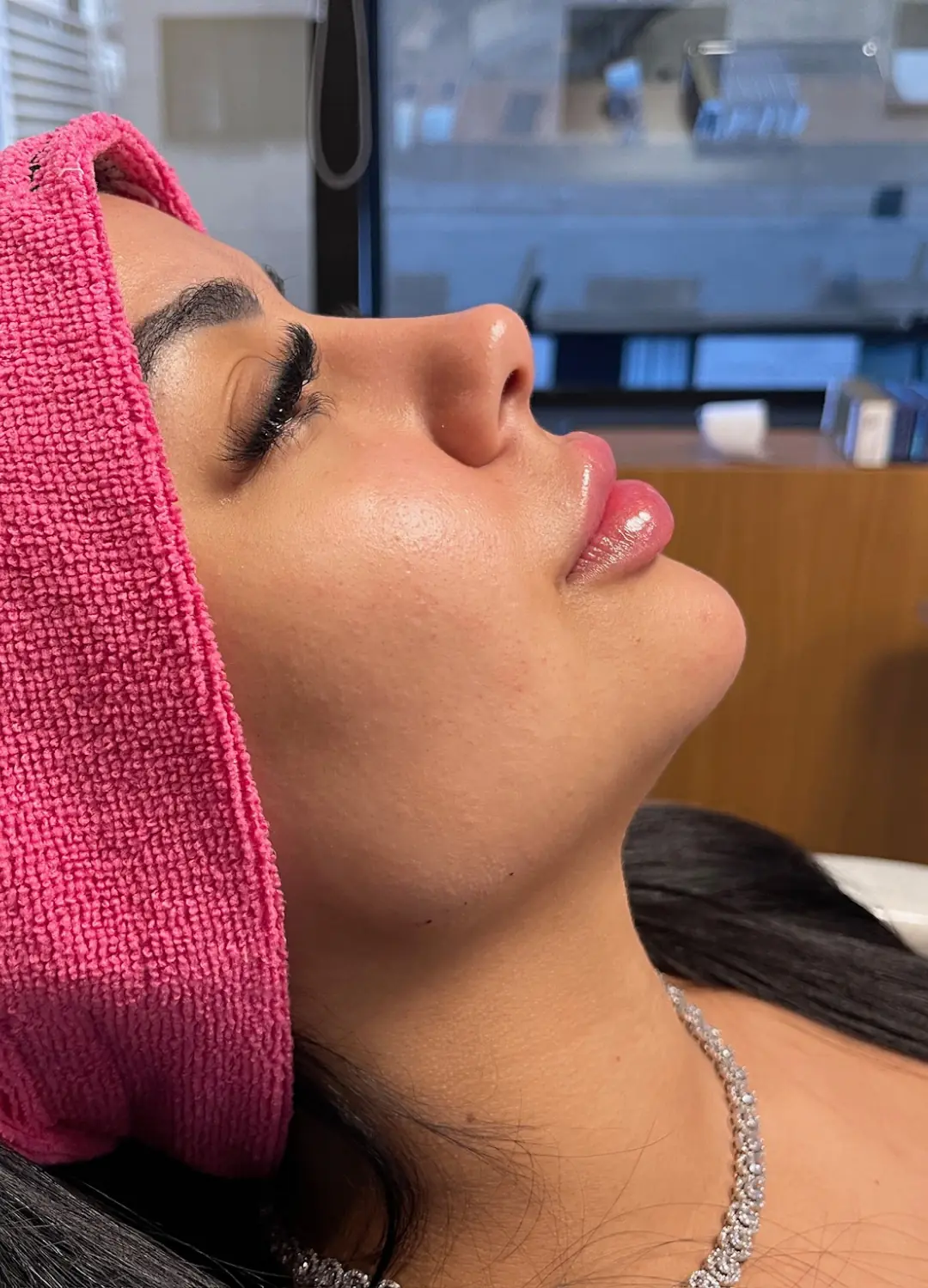 Arquitetura Labial — depois