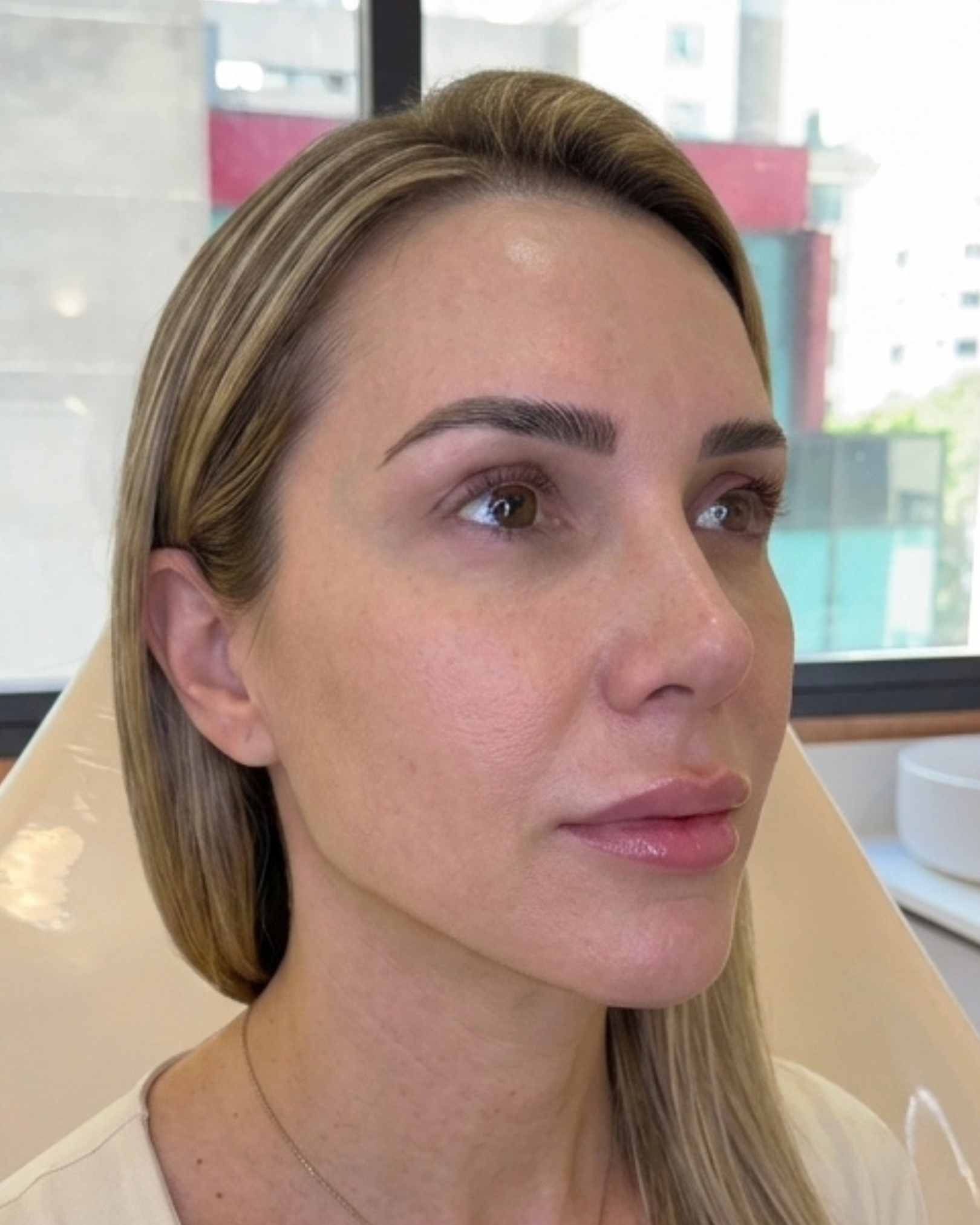 Antes e depois — depois