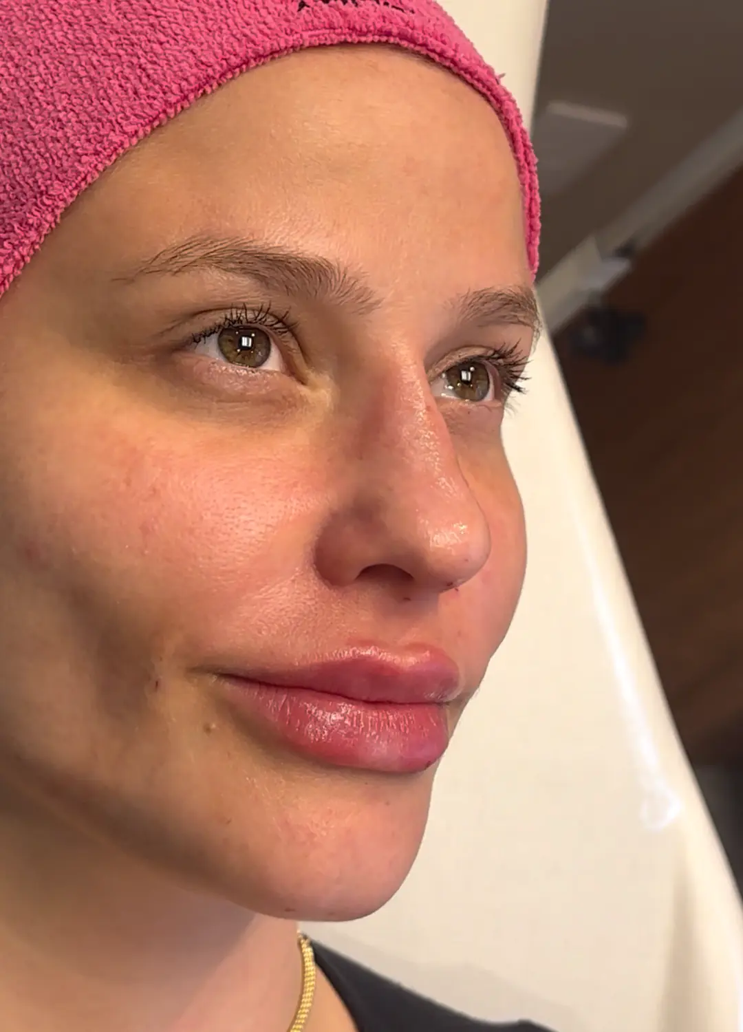 Arquitetura Labial — depois